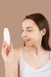 Best Skincare Routine for Acne-Prone Skin
