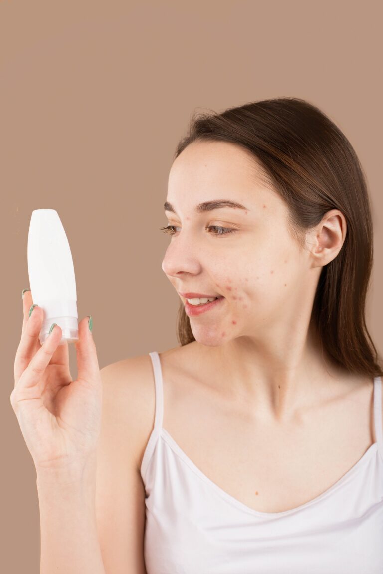Best Skincare Routine for Acne-Prone Skin