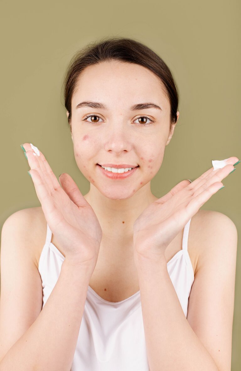 Skin purging vs breakouts comparison showing the differences between temporary purging and acne breakouts.